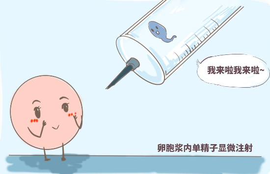 试管婴儿